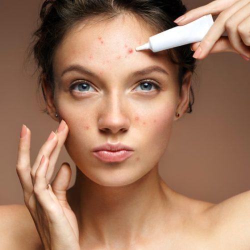 Skin Care